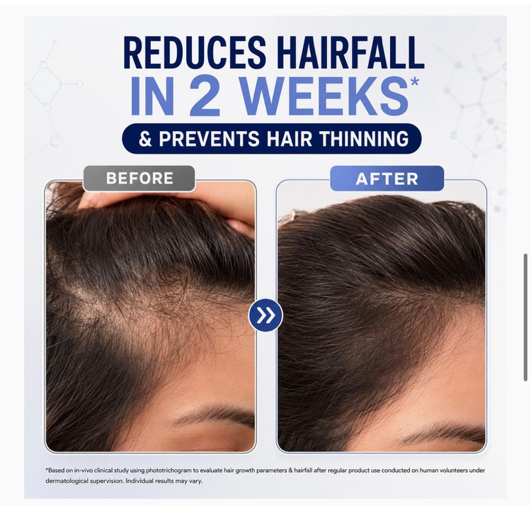 سرم رشد مو WishCare (Hair Growth Serum Concentrate)